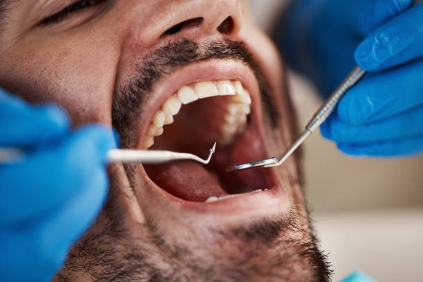 Best Knocked-Out Tooth Emergency  in New Miami, OH