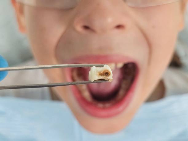 Best Tooth Pain Emergency Relief  in New Miami, OH