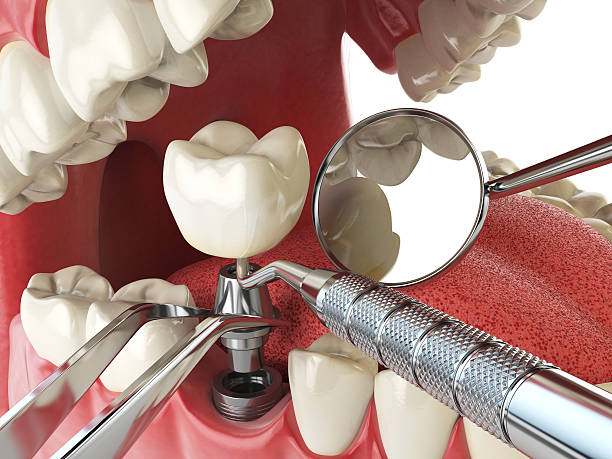 Best Broken Tooth Emergency  in New Miami, OH